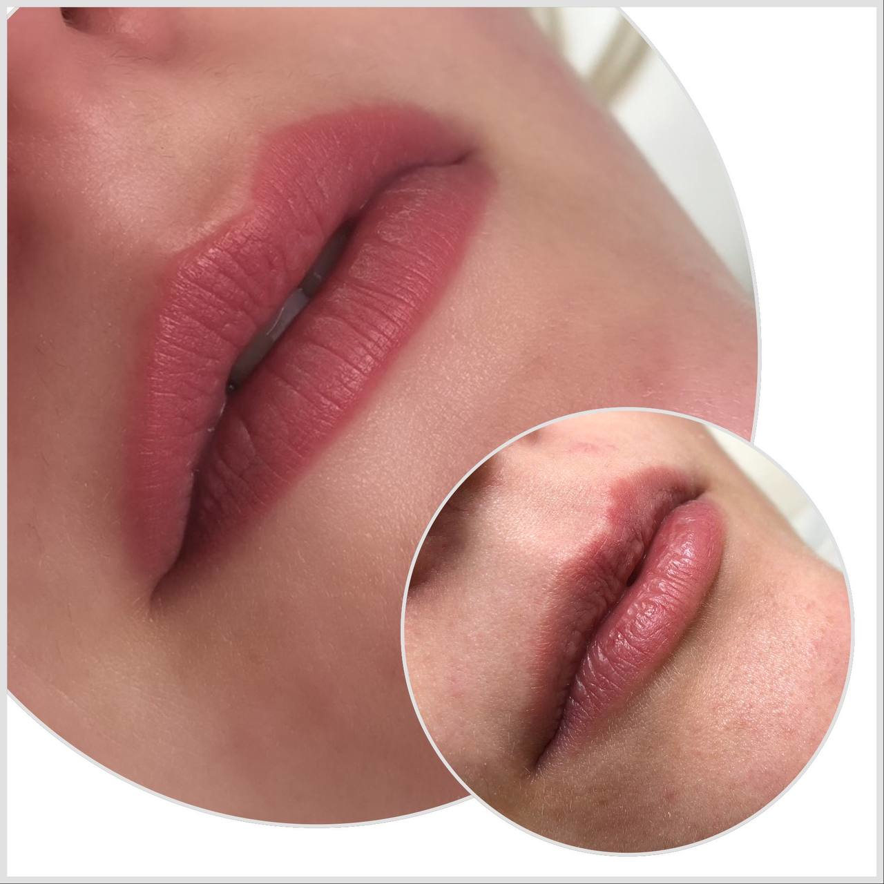 dermopigmentazione-labbra-trucco-semipermanente-cassino-frosinone-vderma