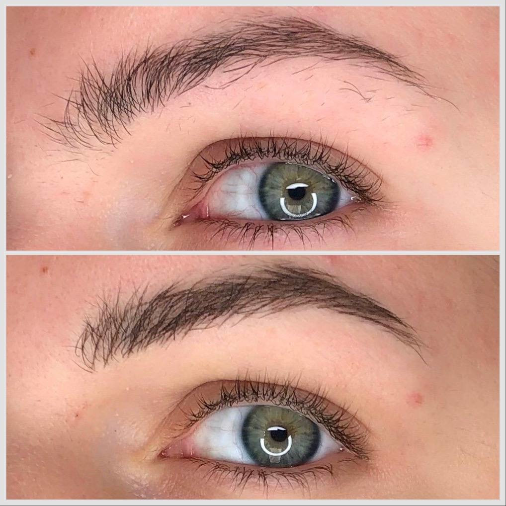 dermopigmentazione-sopracciglia-trucco-semipermanente-cassino-frosinone-vderma